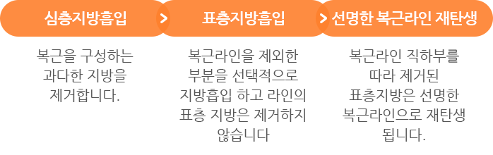 하이맨 복근성형의 특징